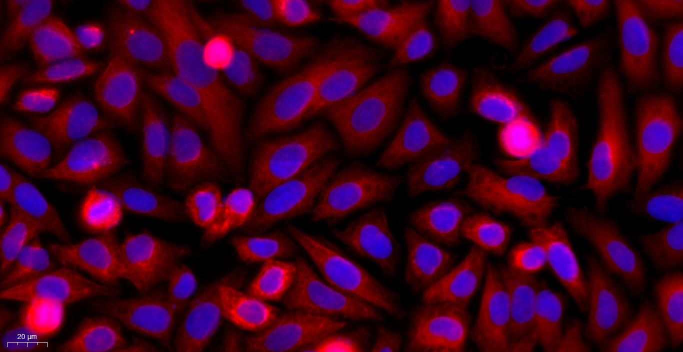 Primary Mouse Neonatal Epidermal Keratinocytes (NEK)