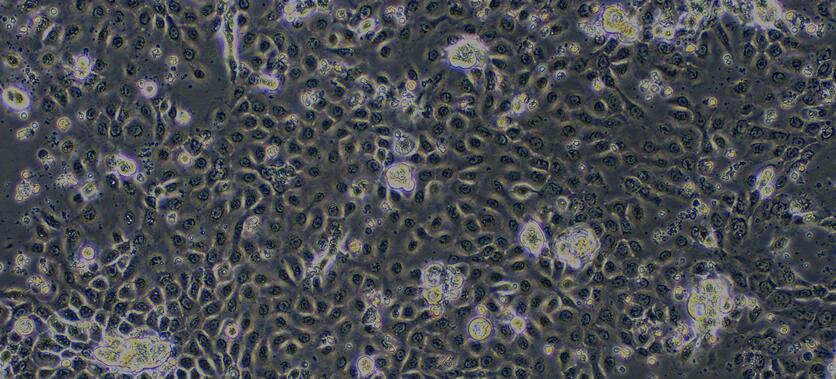 Primary Rat Neonatal Epidermal Keratinocytes (NEK)