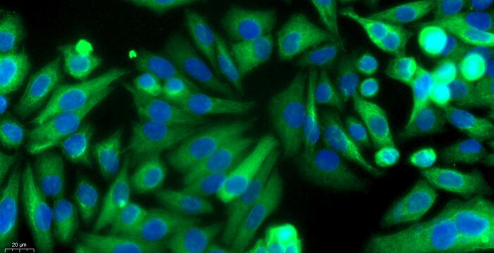 Primary Rabbit Neonatal Epidermal Keratinocytes (NEK)