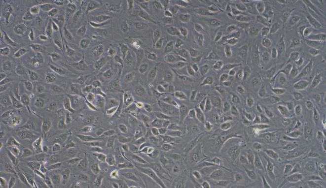 CSI079Hu01.jpg