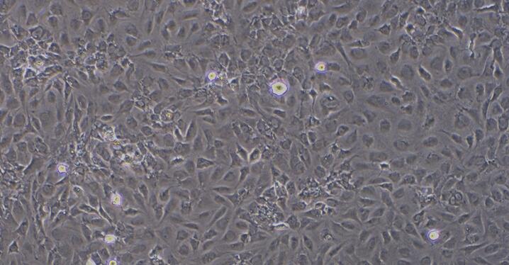 Primary Mouse Dermal Microvascular Endothelial Cells (DMEC)