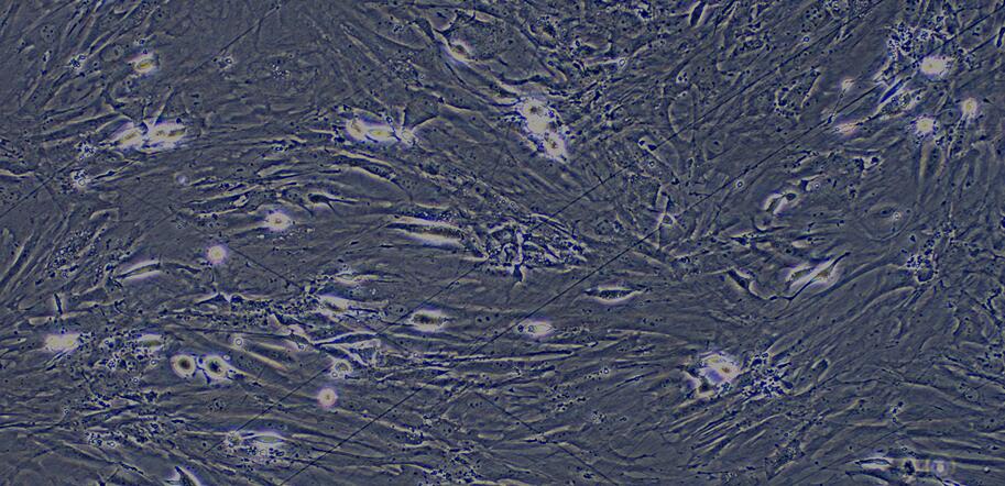 Primary Mouse Visceral Preadipocytes (VPA)