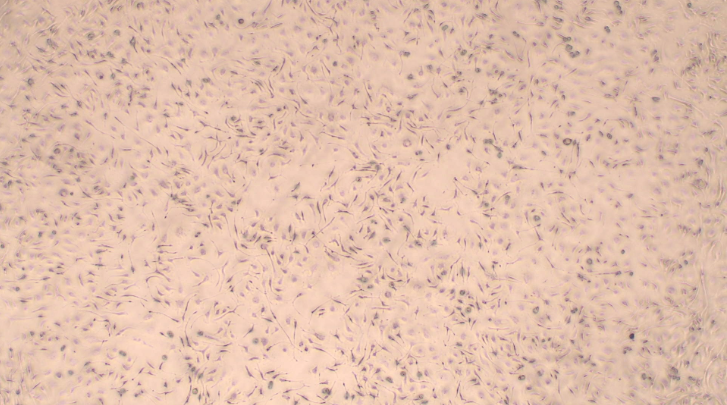 Primary Mouse Bone Marrow-derived Mesenchymal Stem Cells (BMMSCs)
