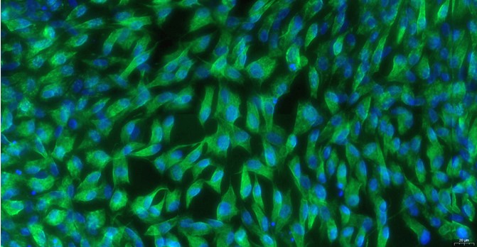 Primary Feline Adult Dermal Fibroblasts (ADF)