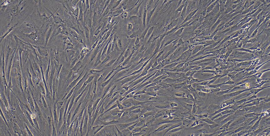 Primary Mouse Neonatal Dermal Fibroblasts (NDF)