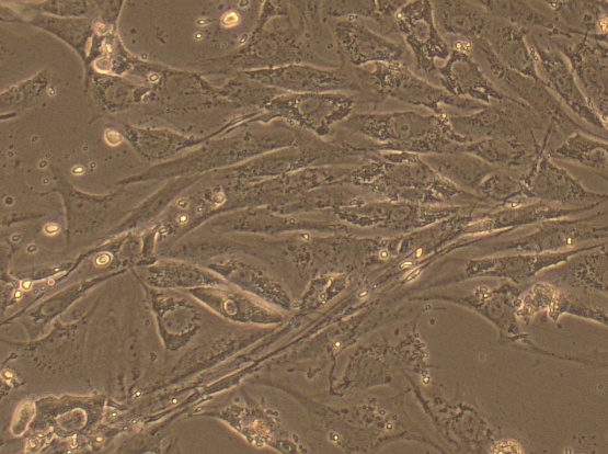 Primary Mouse Bronchial Fibroblasts (BF)