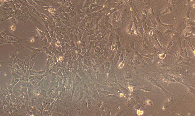 Primary Rat Adrenal Fibroblasts (ADF)