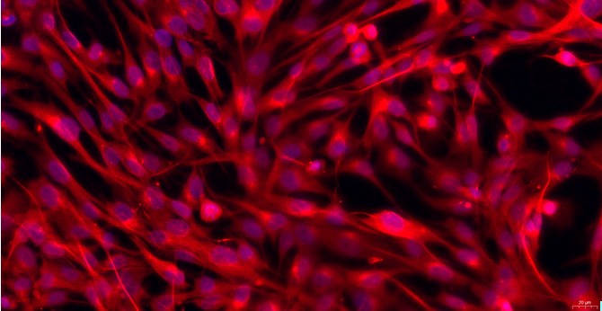 Primary Feline Splenic Fibroblasts (SF)