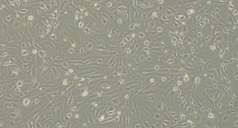 Primary Mouse Splenic Fibroblasts (SF)