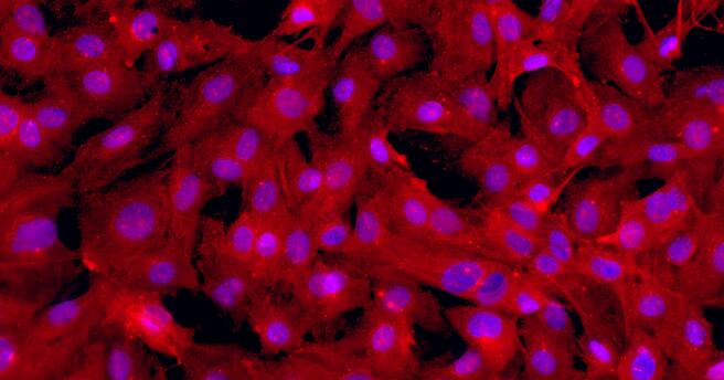 Primary Rat Cardiac Fibroblasts (CF)
