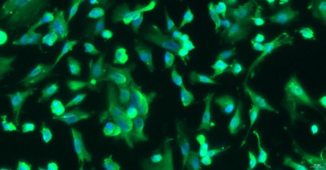 Primary Rat Mammary Epithelial Cells (MEC)