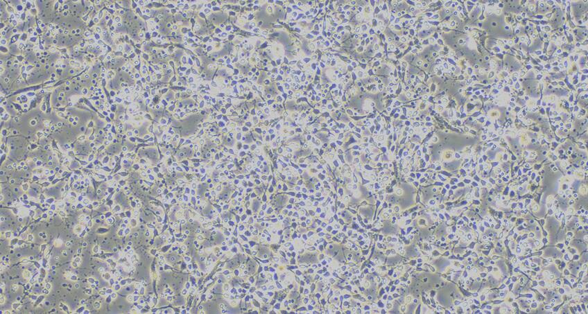 Primary Mouse Hippocampal Neuron Cells  (HNC)
