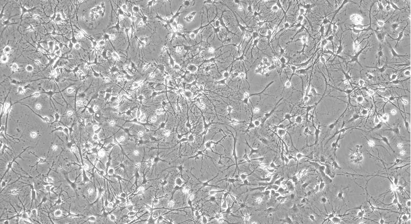 Primary Rat Hippocampal Neuron Cells (HNC)