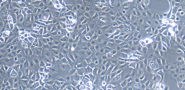 Primary Mouse Colonic Epithelial Cells (CEC)