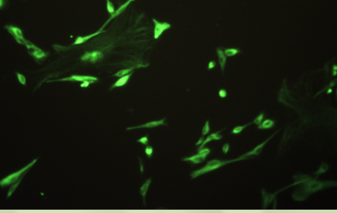 Primary Mouse Esophageal Fibroblasts (EF)