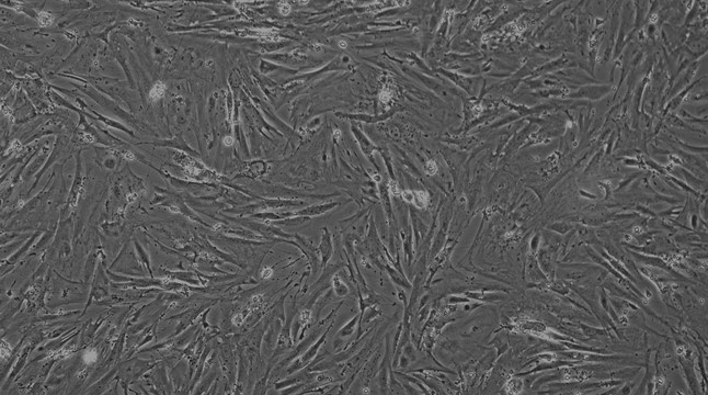 Primary Mouse Esophageal Smooth Muscle Cells (ESMC)