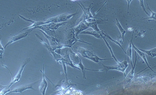 Primary Mouse Esophageal Smooth Muscle Cells (ESMC)