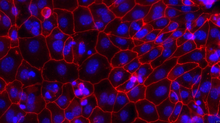 Primary Mouse Cervical Epithelial Cells (CrEC)