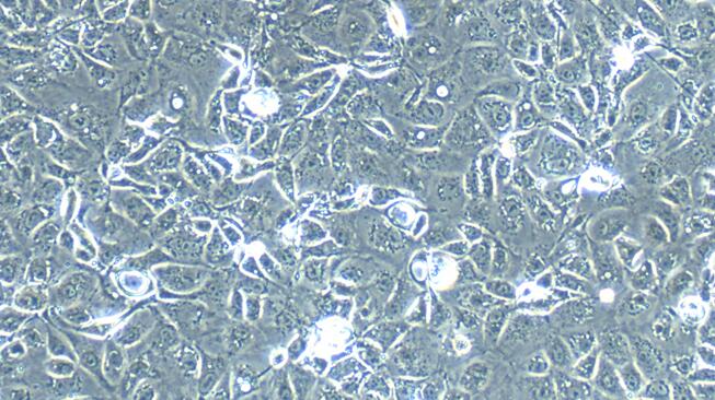 Primary Rabbit Cervical Epithelial Cells (CrEC)