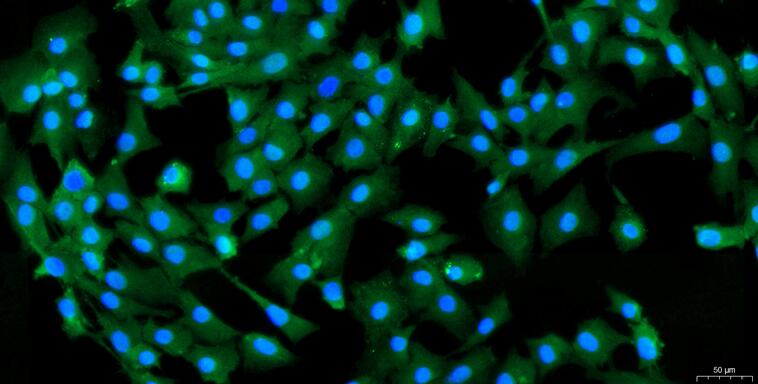 Primary Rat Nucleus Pulposus Cells (NPC)