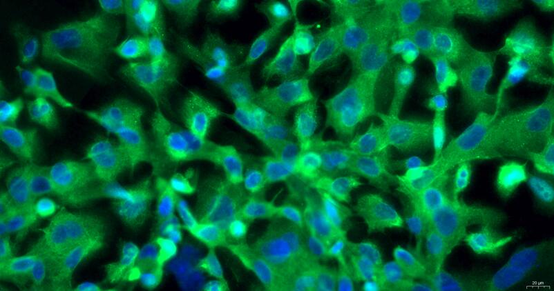 Primary Rabbit Thymic Epithelial Cells (TEC)