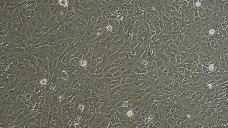 Primary Mouse Adipose Microvascular Endothelial Cells (AMEC)