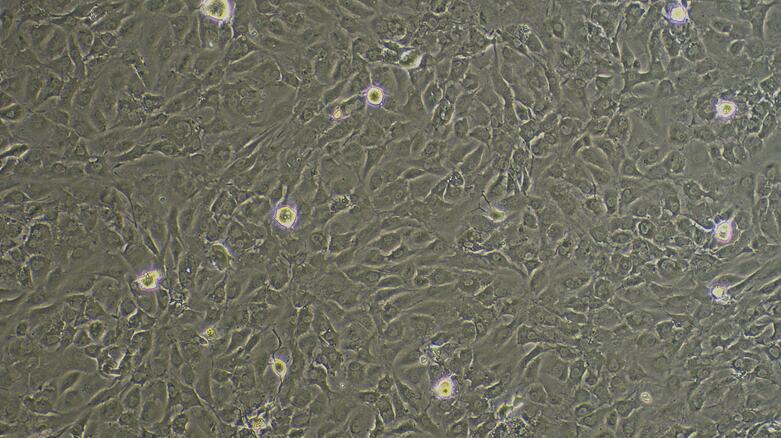 Primary Mouse Adipose Microvascular Endothelial Cells (AMEC)