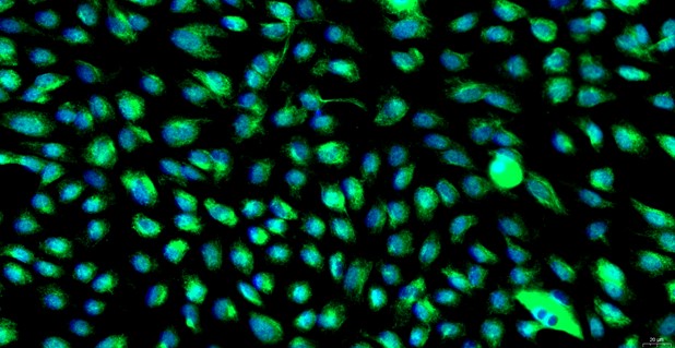 Primary Rat Adipose Microvascular Endothelial Cells (AMEC)