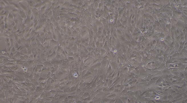 Primary Rabbit Coronary Artery Endothelial Cells (CAEC)