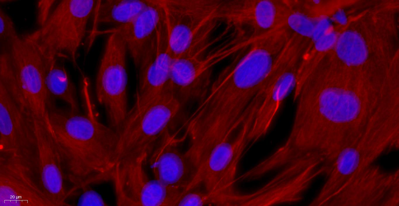 Primary Rat Ovarian Fibroblasts (OF)