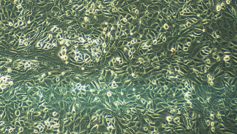 Primary Rat Ovarian Surface Epithelial Cells (OSEC)