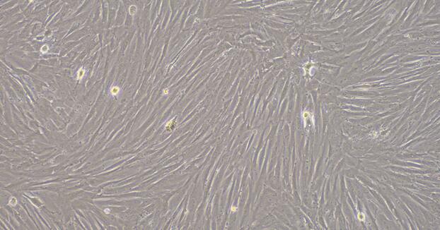 Primary Rabbit Pulmonary Artery Smooth Muscle Cells (PASMC)