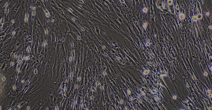 Primary Mouse Prostate Fibroblasts (PF)