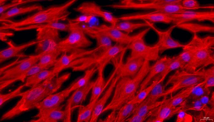 Primary Rabbit Prostate Fibroblasts (PF)