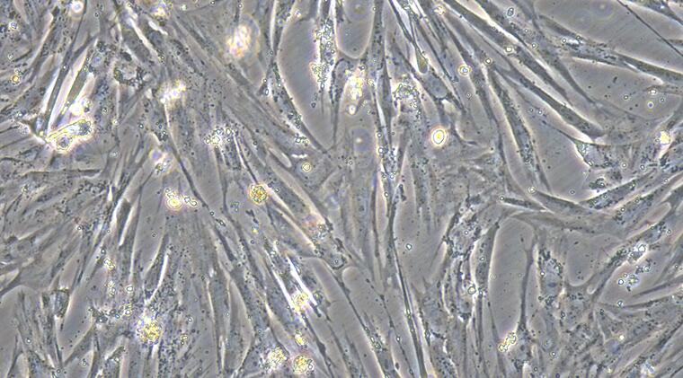 Primary Rat Pancreatic Stellate Cells (PaSC)