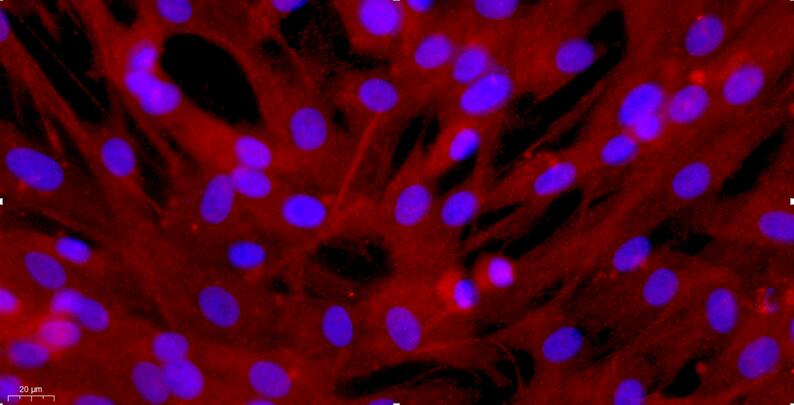 Primary Canine Aortic Smooth Muscle Cells (ASMC)