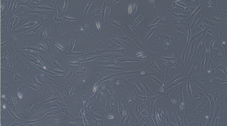 Primary Mouse Aortic Smooth Muscle Cells (ASMC)