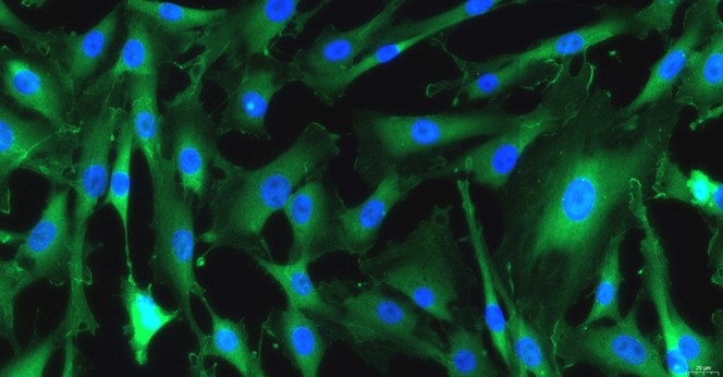 Primary Rat Aortic Smooth Muscle Cells (ASMC)