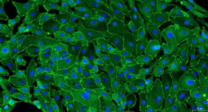 Primary Mouse Seminal Vesicle Epithelial Cells (SVEC)