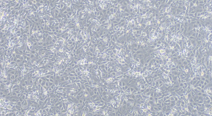 Primary Porcine Prostate Epithelial Cells (PrEC)