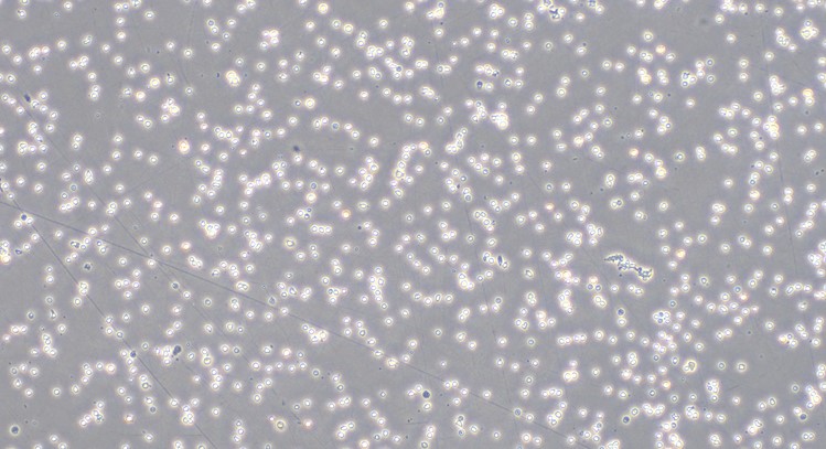 Primary Caprine Peripheral Blood Mononuclear Cells (PBMC)
