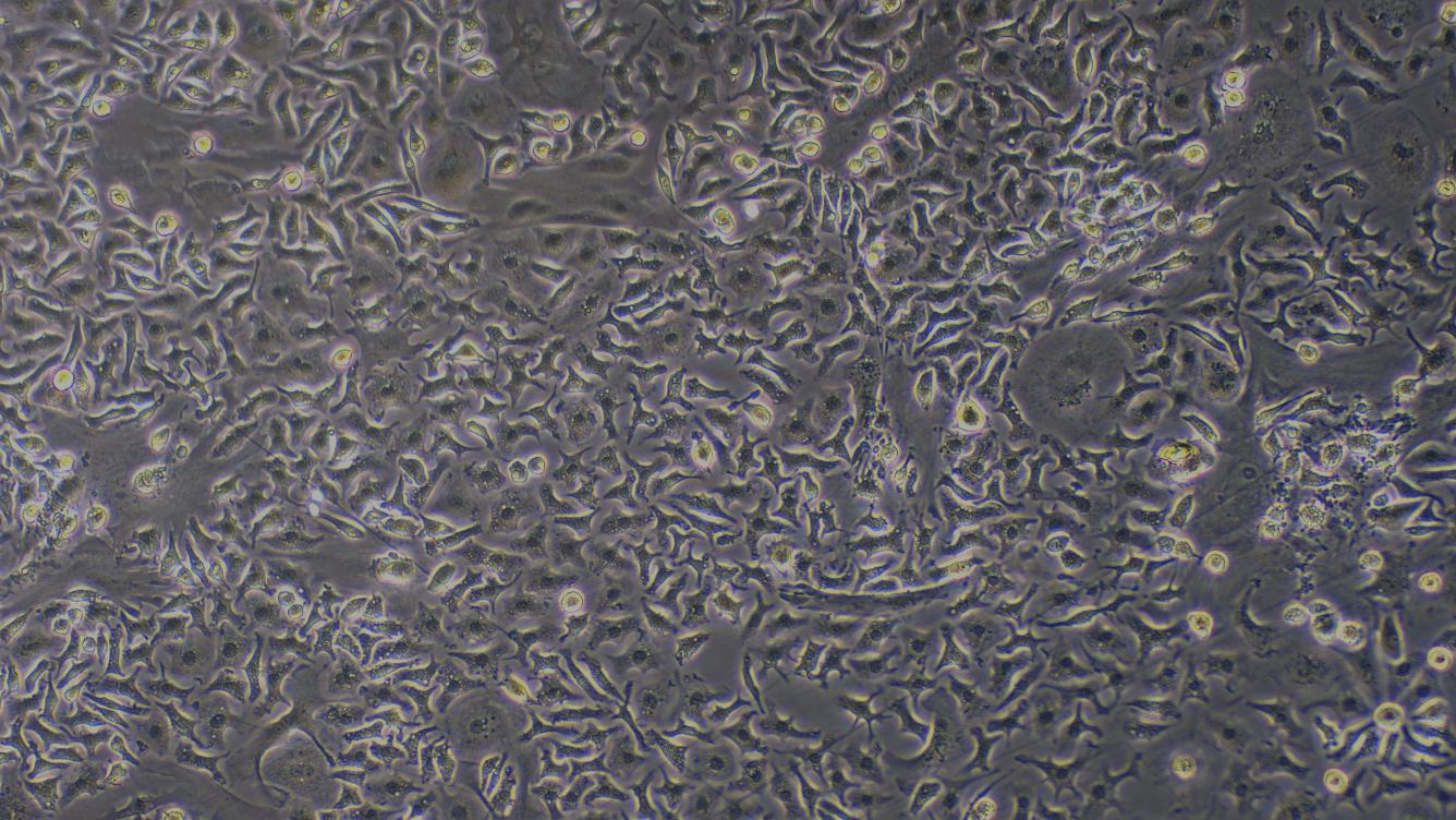 Primary Mouse Hepatic Macrophages (HM)