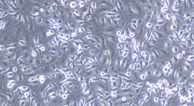 Primary Rat Hepatic Macrophages (HM)