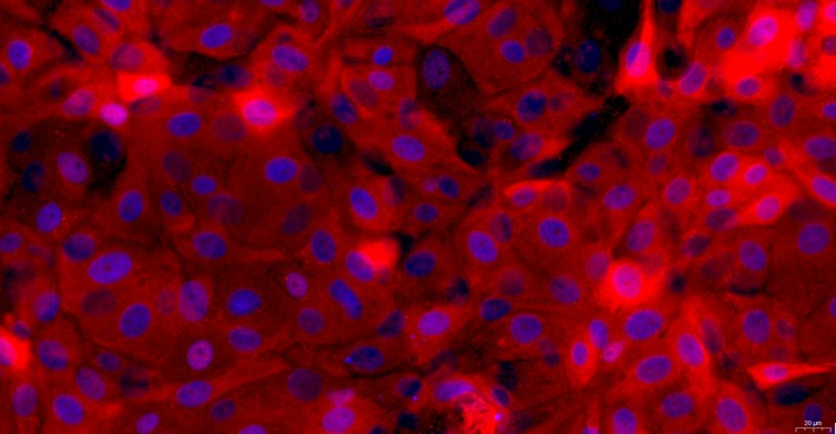 Primary Canine Bladder Epithelial Cells (BEC)