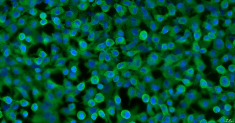 Primary Rabbit Gastric Epithelial Cells (GEC)