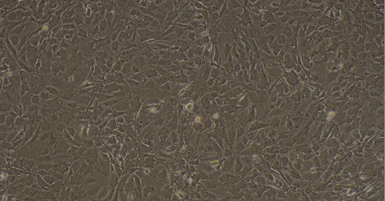 Primary Mouse Skeletal Muscle Myoblasts (SMM)