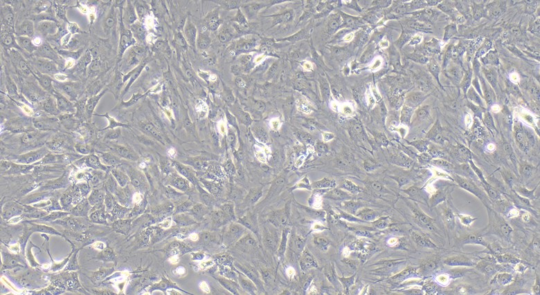 Primary Rat Skeletal Muscle Myoblasts (SMM)