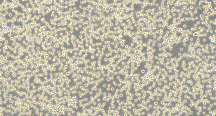 Human Burkitt's Lymphoma Cells (BLC)