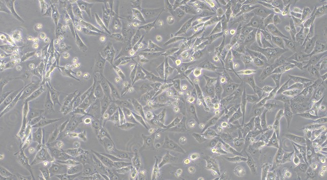 Human Osteosarcoma Cells (OS)
