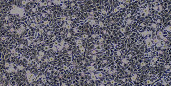 Human Hepatocellular Carcinoma Cells (HCC)